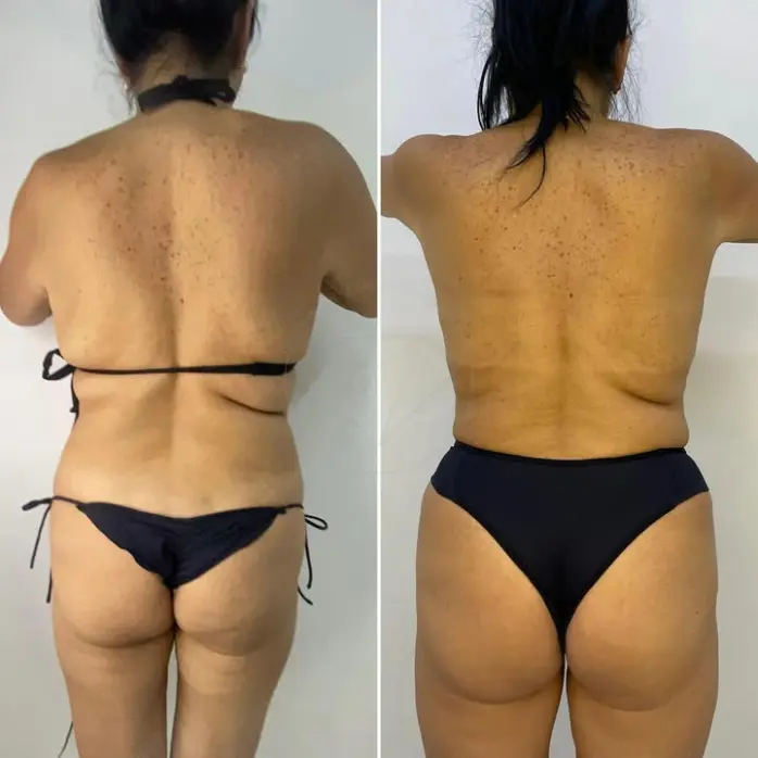 Resultado modelagem e emagrecimento